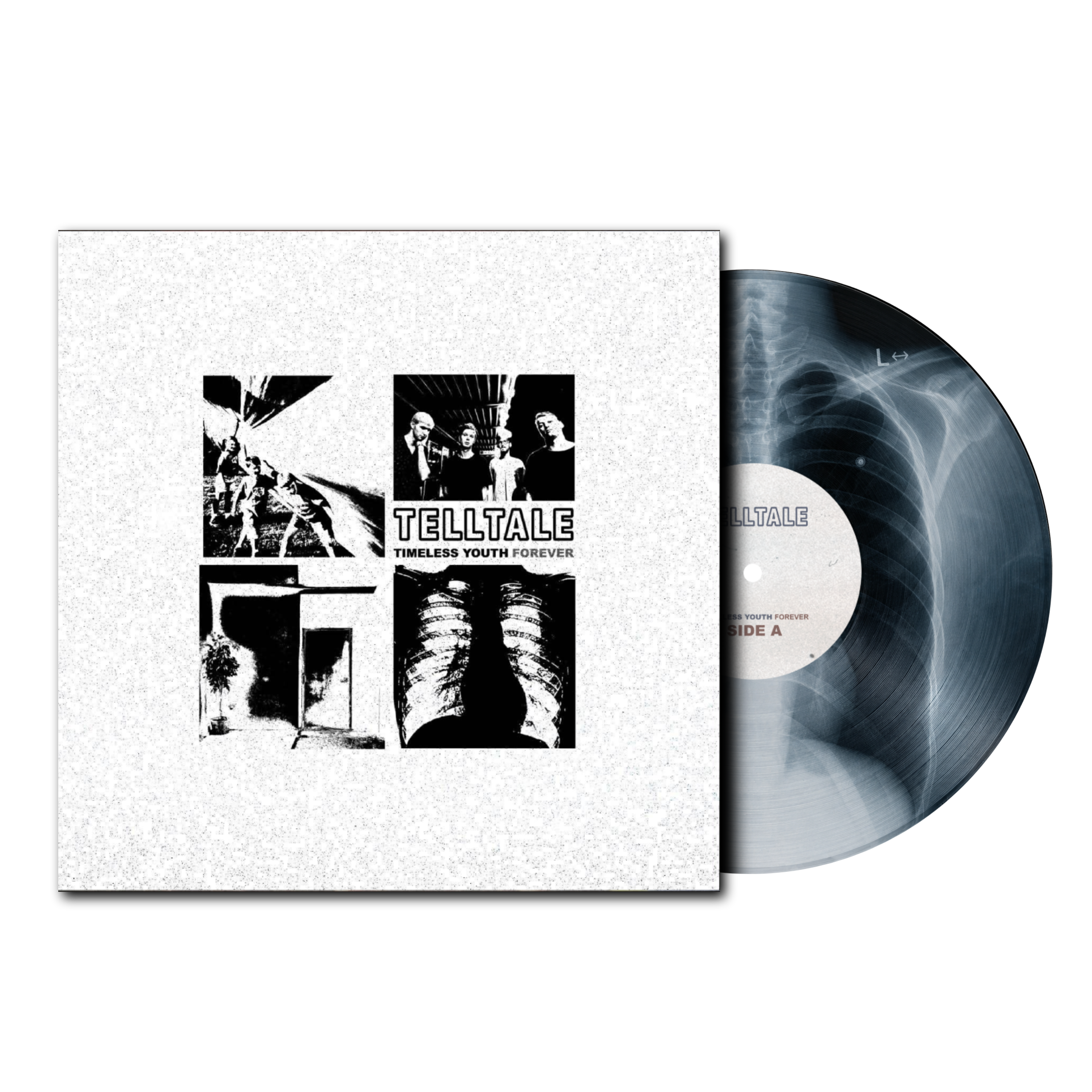 Timeless Youth Forever X-Ray Fill
