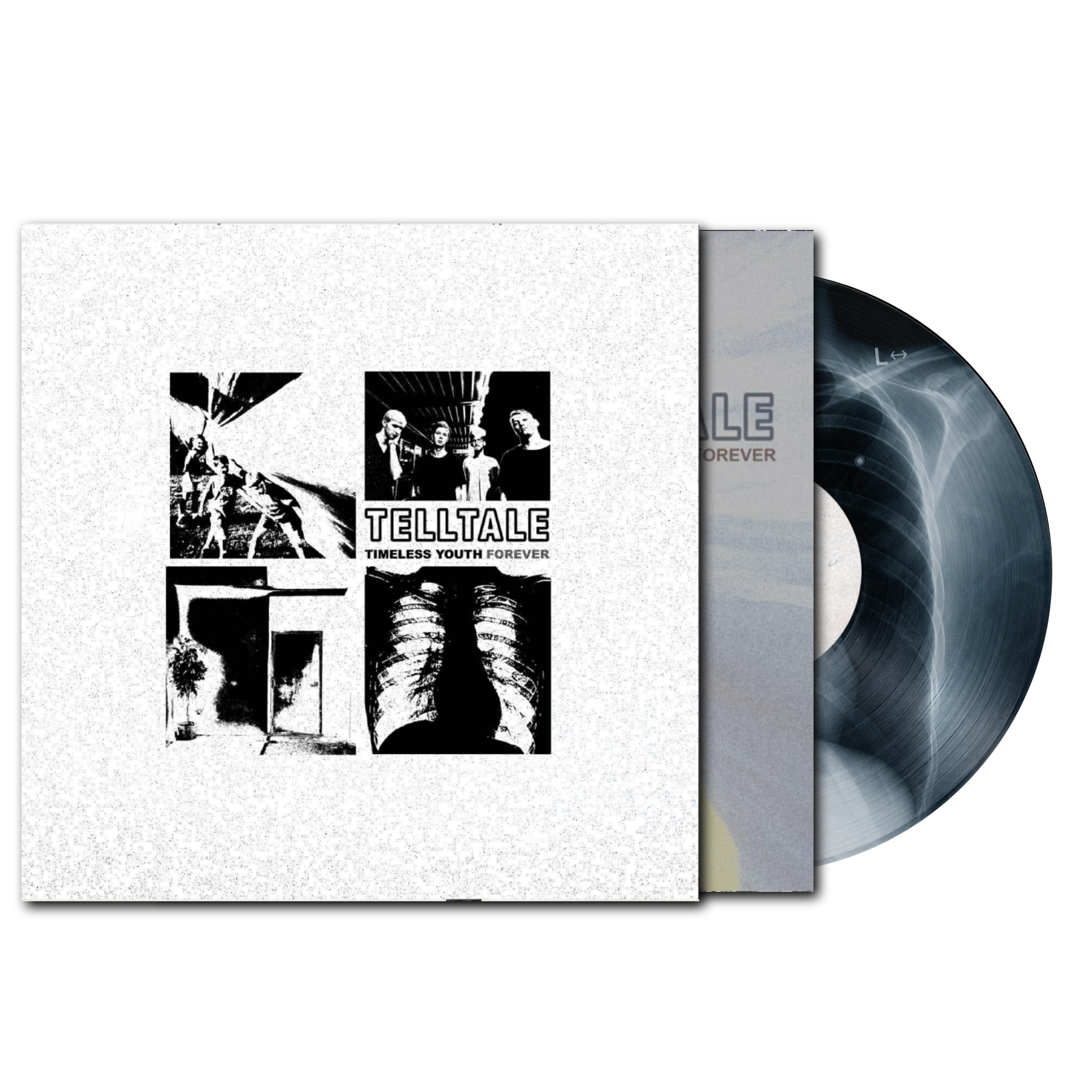 Timeless Youth Forever X-Ray Fill